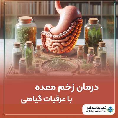 پیشگیری و درمان زخم معده با عرقیات گیاهی